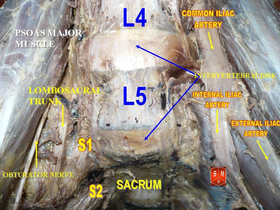 Межпозвоночные диски поясничного отдела позвоночника