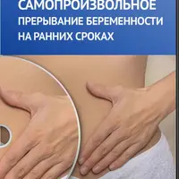 Самопроизвольное прерывание беременности на ранних сроках