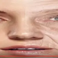 Омоложение лица и шеи за один месяц