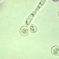 Противогрибковая и противопаразитарная программа