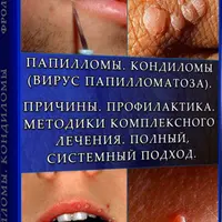 Папилломы. Кондиломы: причины, профилактика и методики лечения