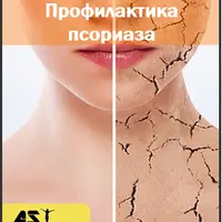 Профилактика псориаза