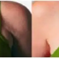 Шея и декольте