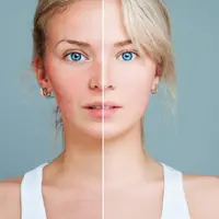 Чувствительная кожа: кто виноват и что делать?