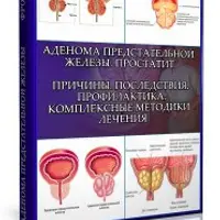 Аденома предстательной железы. Простатит