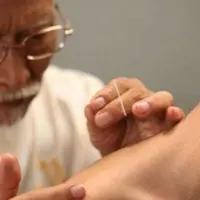 Иглорефлексотерапия. Часть 1