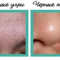 Система «Черных точек нет»