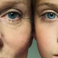 Как вернуть молодость