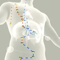 Дивергентные каналы. Хронические болевые синдромы. Принципы работы. Важные точки