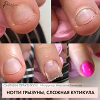 Ногти-грызуны и сложная кутикула. Онлайн-практикум