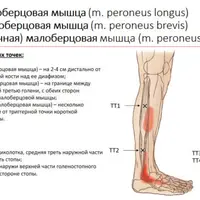 Методичка по триггерным точкам и локализации боли