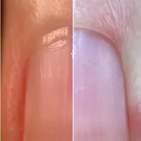 Тонкая налипшая кутикула. Как не поранить и сделать маникюр идеально