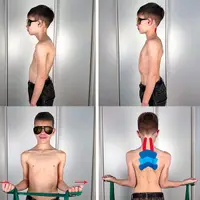 Лечение патологий грудного отдела позвоночника. Онлайн-практикум