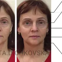 Марафон Face Fitness Pro. Сбрось 5 лет к Новому году