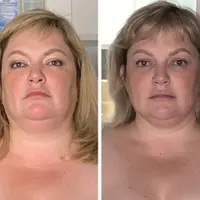 Омоложение лица и упражнения на всё тело