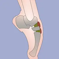 Бедро, голень, стопа