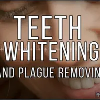 Отбеливание зубов