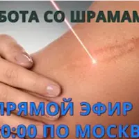 Работа со шрамами