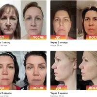 Гимнастика для лица Top Face