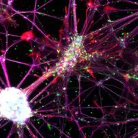 При всех видах рака - C. R