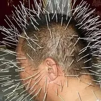 Внеканальные точки