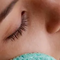 Удаление родинок