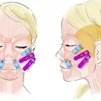 Тейпирование лица