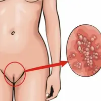 Регенерация и исцеление влагалища