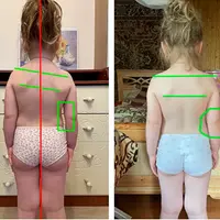 Здоровые стопы и осанка за лето. Курс оздоровительных упражнений для детей 4-12 лет