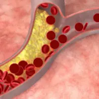 Заживление и регенерация вен