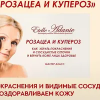 Розацеа и Купероз