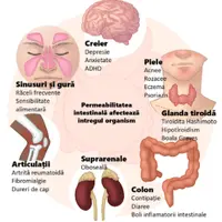 Заживление и регенерация синдрома дырявой кишки