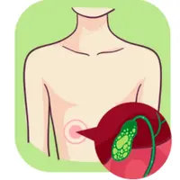 Как избавиться от камней в желчном пузыре