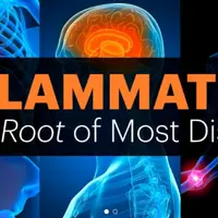 Воспаление