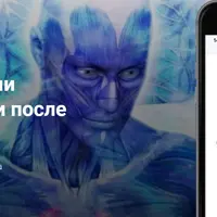 Боремся с когнитивными нарушениями после COVID-19