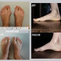 Здоровые ноги 3.0