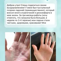 Психосоматика