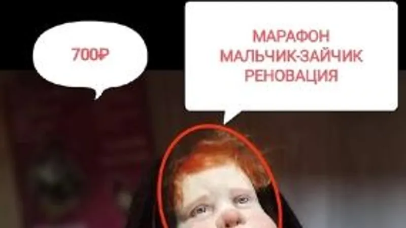Мальчик-зайчик реновация