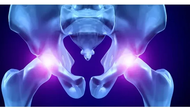 Цикл лекций: Тазобедренный сустав. Лекция 5