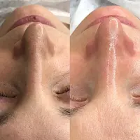 Академия пилингов