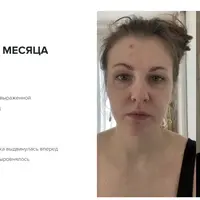 Лицо. Кости