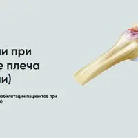 Протокол реабилитации при импиджменте плеча (без операции)