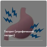 Лечебный протокол "Гастрит (атрофический гастрит)"