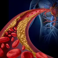 Школа Холестерина