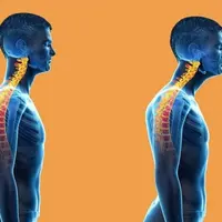 Мощная коррекция положения головы