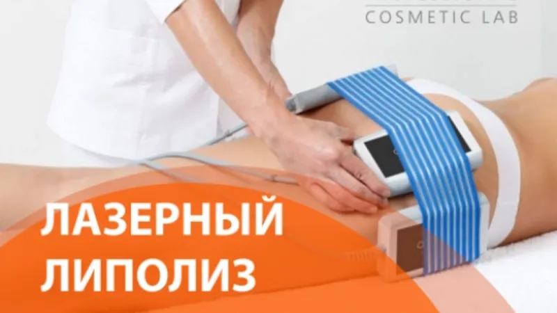 Лазерный липолиз