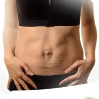 Убираем диастаз