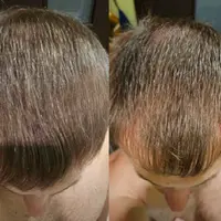 Волосы. Все секреты роста