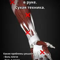 Массаж триггерных точек в руке