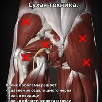 Массаж триггерных точек в ягодице, животе и груди